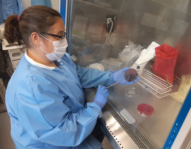 Aspirus testing for COVID19 antibodies News, Sports, Jobs The